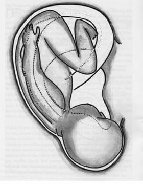 Abb. 1: Projektion eines Embryo auf die Ohroberfläche aus dem Buch "Ohrakupunktur" von Michael Noack