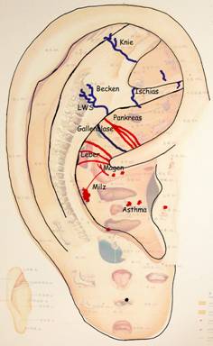 Abb. 3: Links sichtbare Gefäße in den Bereichen Schulter, Halswirbelsäule (HWS), Brustwirbelsäule (BWS), Ellenbogen und das sog. Immunologische Gefäß